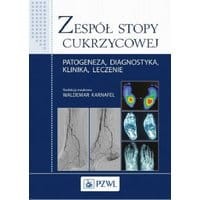 Zespół stopy cukrzycowej