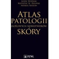 Atlas patologii złośliwych nowotworów skóry