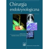 Chirurgia endokrynologiczna