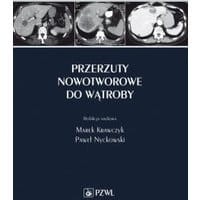 Przerzuty nowotworowe do wątroby