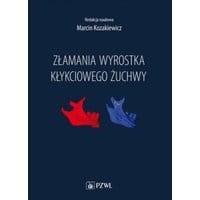 Złamania wyrostka kłykciowego żuchwy